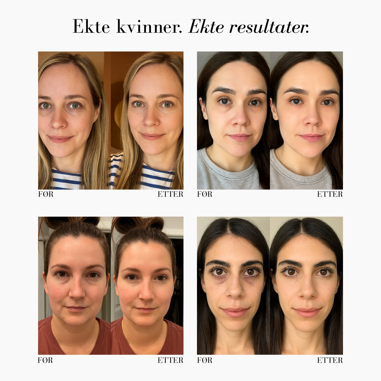 CC Øyekorrigerer